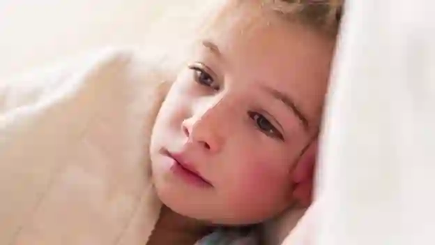 Скарлатина у детей: симптомы и лечение