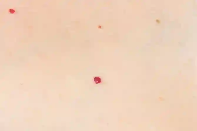 Красные точки на коже: это опасно?