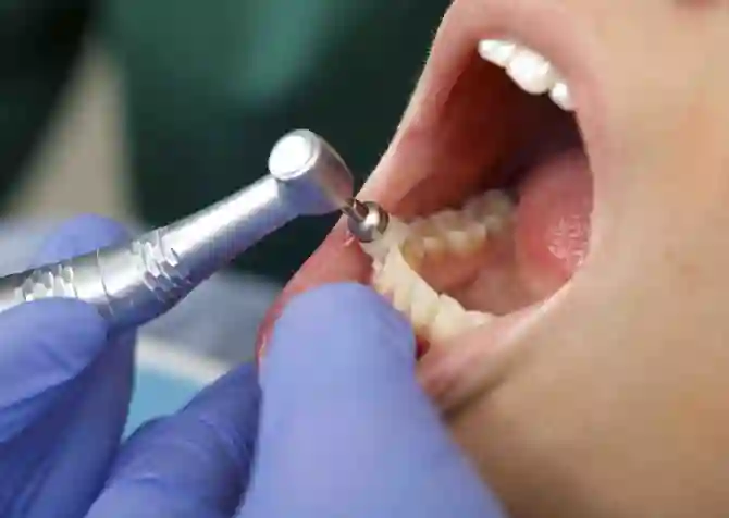 Четыре способа удалить зубной камень