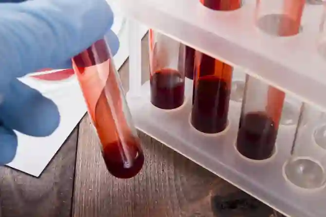 SARS-CoV-2: могут ли антитела из крови исцеленных людей помочь?