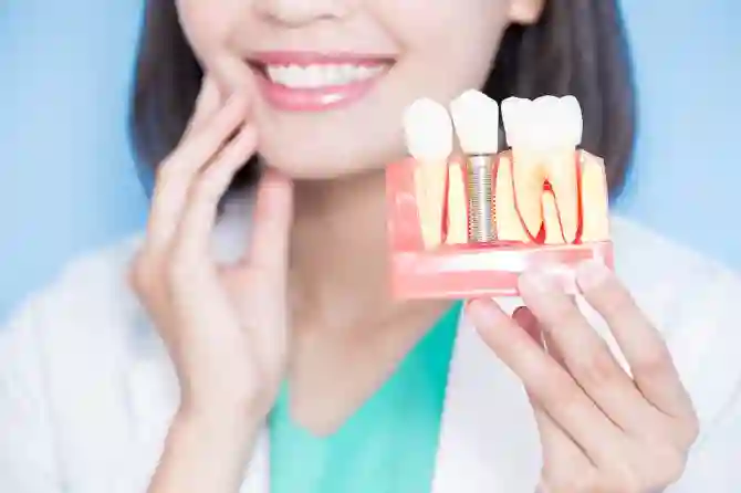 Зубные имплантаты: разновидности, установка и уход